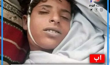 عصابة حوثية تعدم طفل بعد سرقته شرق اب اليمنية