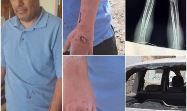 مليشيات الحوثي في صنعاء تعتدي على اكاديمي بالضرب المبرح بخلفية مطالبته بمرتبه