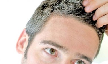 أسباب للشيب المبكر تجنّبها