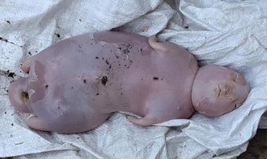 ولادة نادرة في ردفان.. نعجة تضع مولودًا بملامح بشرية (صور)