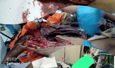 جرائم مليشيا الحوثي لم تتوقف شمال الضالع (قصة مأساوية)