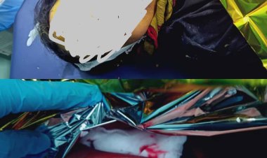 استشهاد إمرأة برصاص مليشيات الحوثي في قعطبة شمال الضالع ..