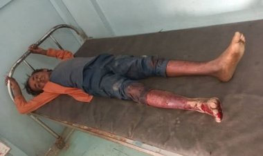 إصابة طفل بانفجار جسم متفجر من مخلفات مليشيا الحوثي في ريف حيس بالحديدة