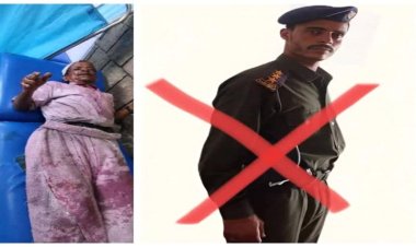 إرهاب الحوثي يتجاوز الحدود: إحراق مسن بالزيت المغلي في إب اليمنية بسبب زلابيا