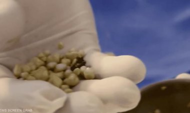 المشروبات الغازية تُهدد حياتك: طبيب يستخرج 30 حصوة من كلية رجل بسبب الصودا!