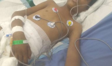 استشهاد طفل متأثرًا بإصابته برصاص قناص حوثي في كرش بلحج