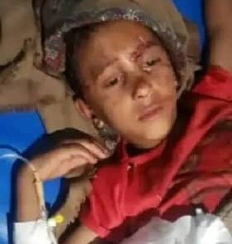 هجوم ضبع مفترس يُصيب طفل يمني بجروح خطيرة: والأهالي يتدخلون لإنقاذه!
