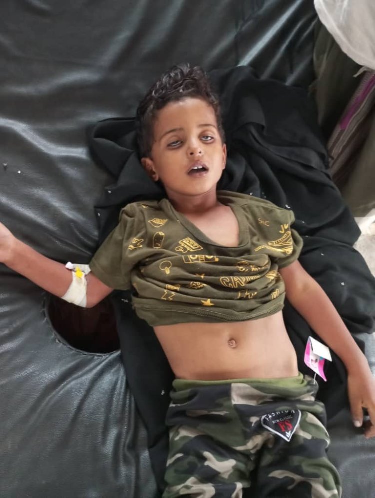 ​وفاة طفل بالإسهال المائي في الضالع تثير مخاوف من تفشٍ محتمل للمرض