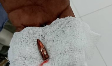 إصابة لاعب كرة سلة في شبام برصاص راجع إثر إطلاق نار مجهول المصدر