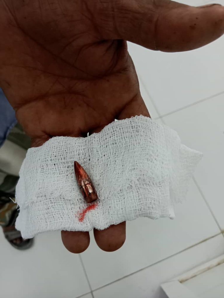 إصابة لاعب كرة سلة في شبام برصاص راجع إثر إطلاق نار مجهول المصدر