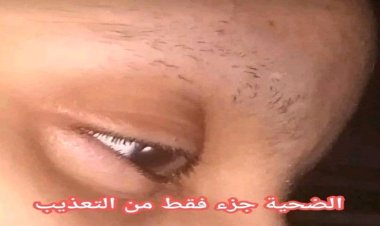 حلق شعرها وحواجبها ثم احرقها .. محامي يعذّب زوجته بطريقة مروعة في تعز