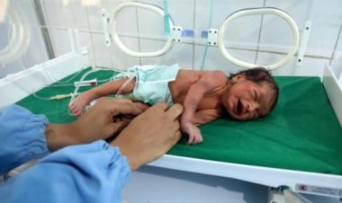 الصحة العالمية : اليمن يسجل ولادات ميتة تفوق المعدل العالمي بـ50%