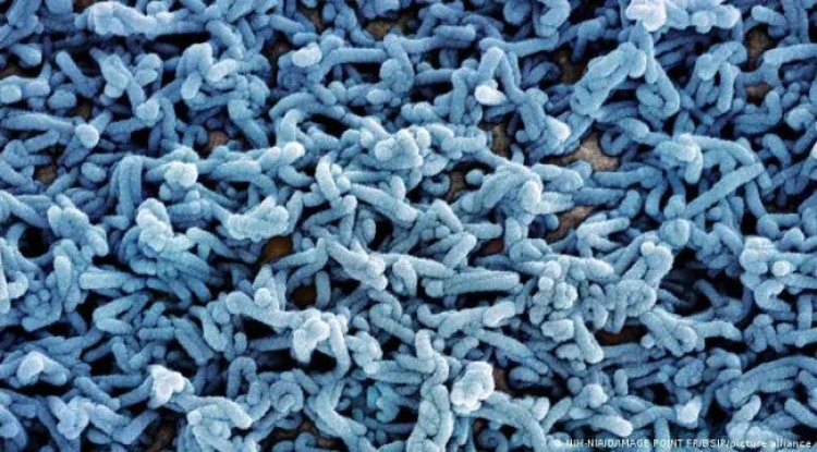 إثيوبيا تحذر من فيروس ماربورغ.. اليمن على رأس الدول المعرضة للخطر