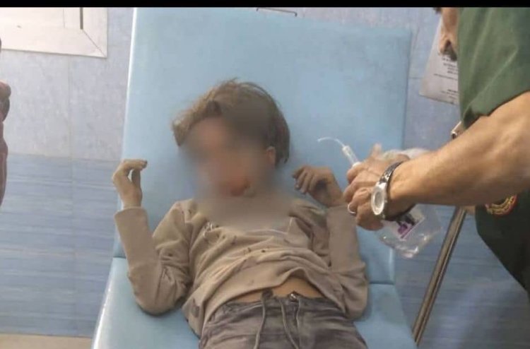 تعز اليمنية | إصابة طفل وفتاة بقصف مدفعي لمليشيا الحوثي الإرهابية استهدف أحياءً سكنية شرق المدينة