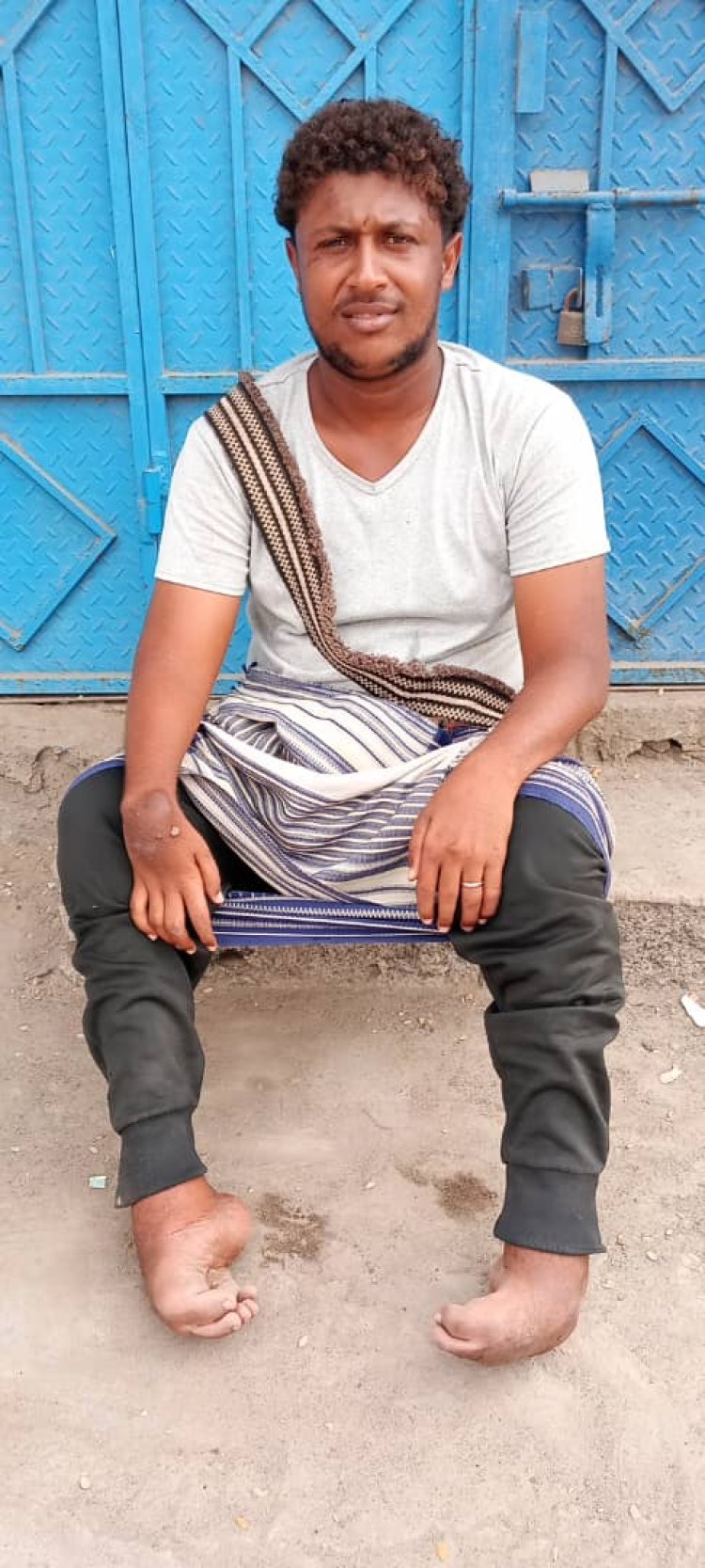 شاب من أبين يناشد ضمائر الخير والمنظمات الإنسانية توفير كرسي كهربائي متحرك