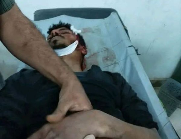 استشهاد شاب من الأزارق خلال مواجهات مع المليشيا الحوثية في جبهة مريس