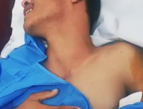 جراحٌ تنطق بالولاء.. من قلب العمليات الجندي مهيب الأغبر يجدد العهد