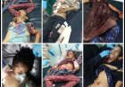 13 طفلاً بين شهيد وجريح.. مؤسسة الضالع للإعلام توثق جريمة حرب جديدة في حجر الضالع