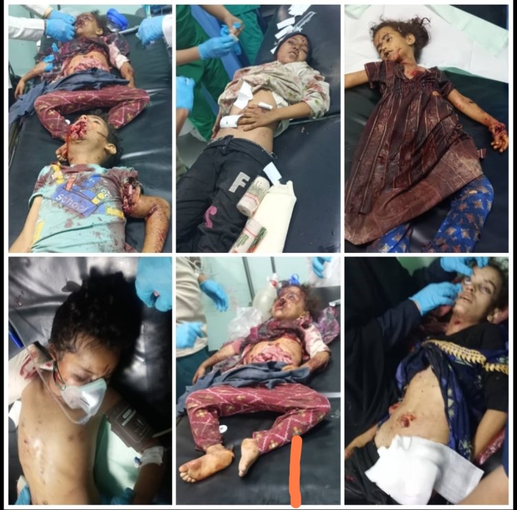 13 طفلاً بين شهيد وجريح.. مؤسسة الضالع للإعلام توثق جريمة حرب جديدة في حجر الضالع