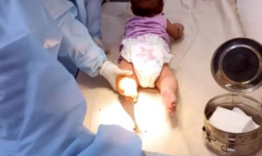 مركز الأطراف الصناعية والعلاج الطبيعي/عدن يشهد إنجازات وخدمات جديدة تواكب تطلعات واحتياجات المرضى