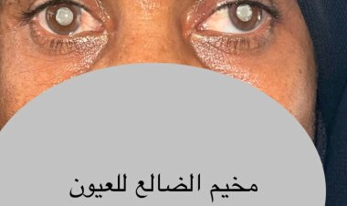 من ظلمة العمى إلى نور الأمل.. قصة أم من الضالع تبكي سنوات ضاعت من بصرها ..